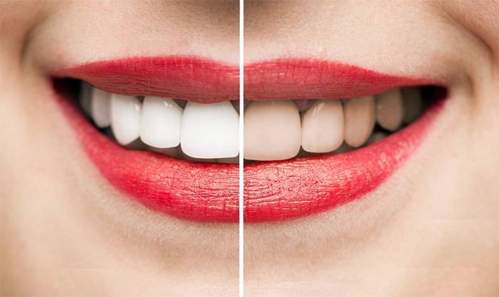 ����������� ����� � �������� ������